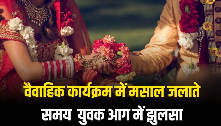 वैवाहिक कार्यक्रम में मसाल जलाते समय युवक आग में झुलसा