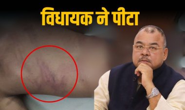 युवक ने मांगी सैलरी तो विधायक ने पीट डाला