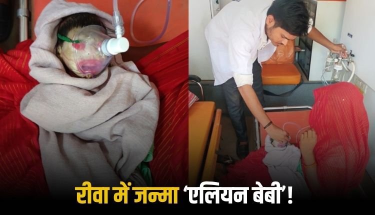 जिले में जन्मा विकृत नवजात, डॉक्टर भी रह गए हैरान, शरीर असामान्य और क्षत-विक्षत