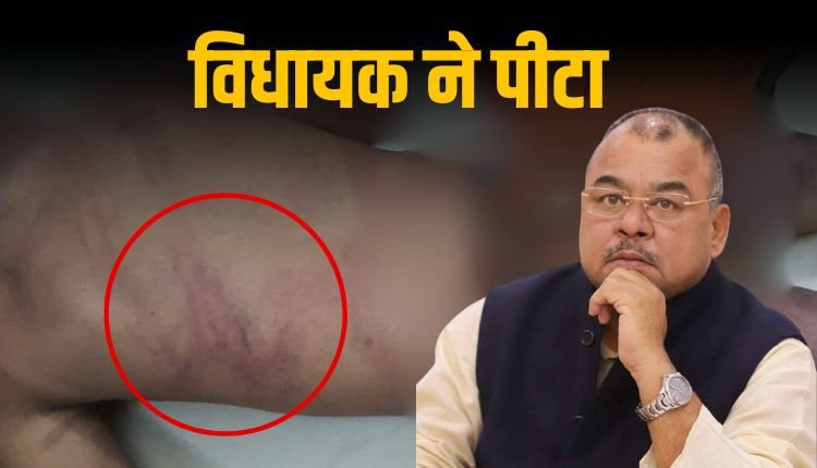 युवक ने मांगी सैलरी तो विधायक ने पीट डाला