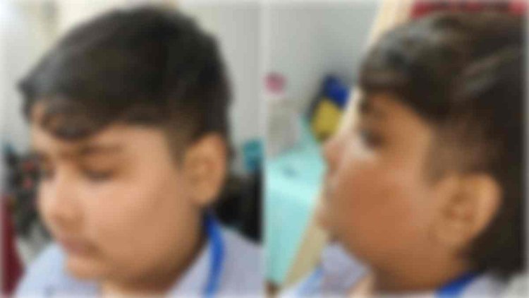 गुरुनानक स्कूल में छात्र से मारपीट,  FIR दर्ज