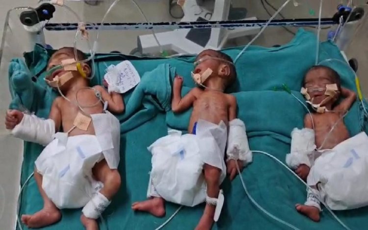 GMH में महिला ने एक साथ तीन बच्चों को दिया जन्म, मां की हालत गंभीर
