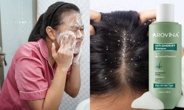 क्या एंटी-डैंड्रफ शैम्पू से ठीक हो सकते हैं Acne? जानिए सच