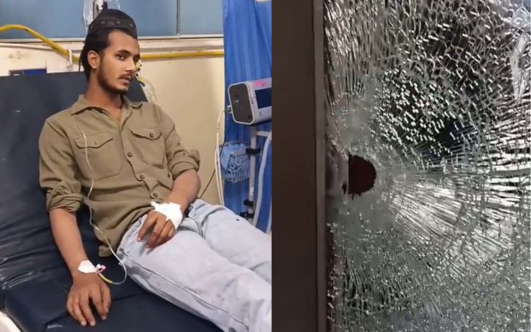 BHOPAL: लल्लू रईस के घर फायरिंग, बेटे इमरान को लगी गोली