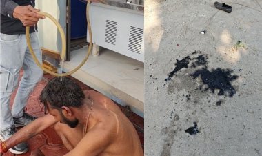 Bhopal: 10 नंबर मार्केट में व्यापारी ने खुद को लगाई आग