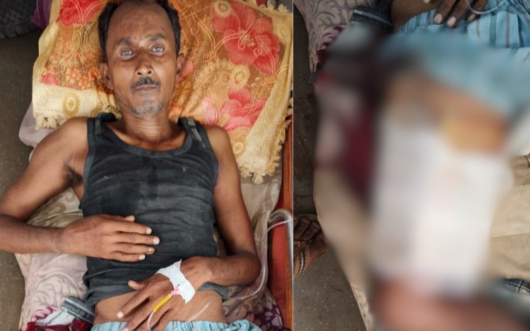 मऊगंज में जंगली सूअर का कहर, बगीचे में रखवाली कर रहे किसान पर हमला, हालत गंभीर रीवा रेफर