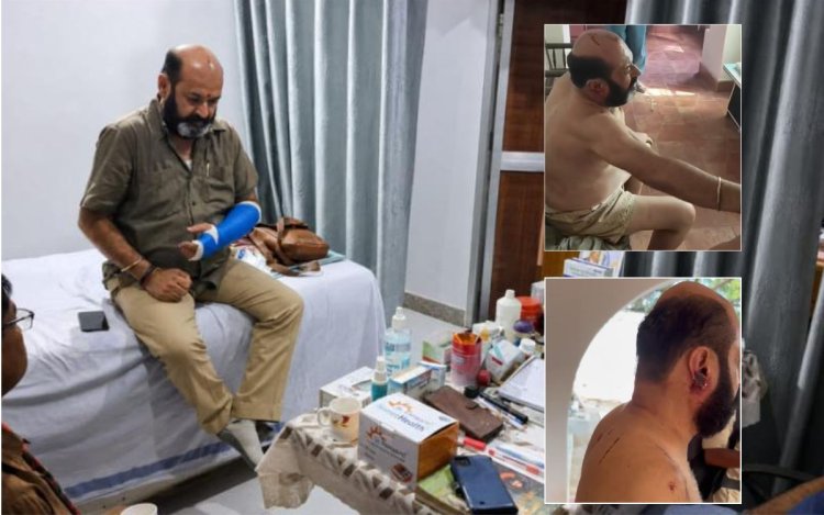 नागौद राजघराने गोलीकांड में नया खुलासा: फायरिंग से पहले हुई बाबा राजा की जमकर पिटाई
