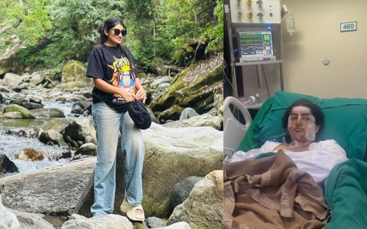 इंदौर गैस पाइपलाइन ब्लास्ट: इंफ्लुएंसर का ICU से वीडियो जारी, जिनी झाला ने बताया- लोग तमाशा देख रहे थे