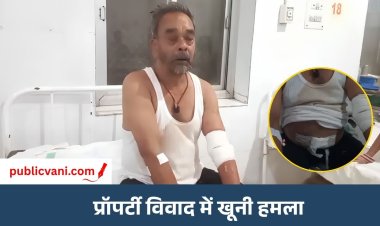 प्रॉपर्टी विवाद में बुजुर्ग पर ग्राइंडर से हमला: हाथ काटने की कोशिश, पत्नी-बेटों पर आरोप