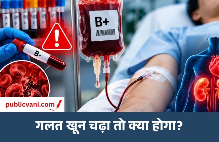 Health Alert : मरीज को गलत ब्लड ग्रुप का खून चढ़ जाए तो क्या होगा? इन लक्षणों को भूलकर भी न करें नजरअंदाज